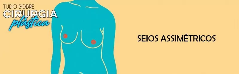 Tipos de Seios: Saiba Tudo Sobre Eles!
